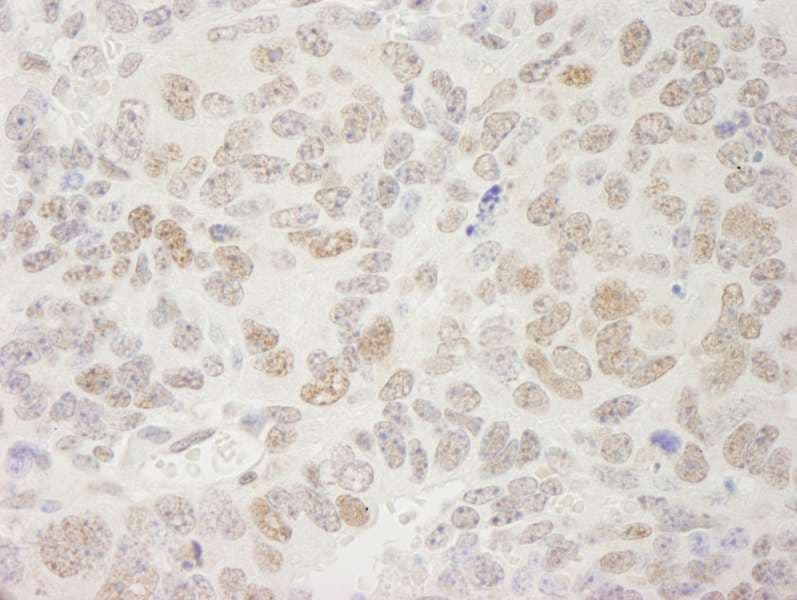 Polyclonal Rabbit anti-Human SPT5 / SUPT5H Antibody (aa1040-C-term, IHC)