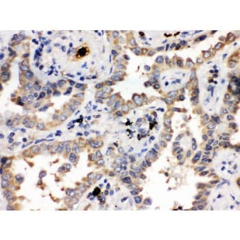 Polyclonal Rabbit anti-Human ULK3 Antibody (aa427-454, IHC, WB)