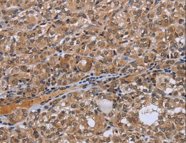 NRP2 / Neuropilin 2 Antibody