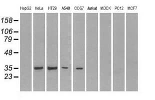 CD32A Antibody (clone OTI20D1)