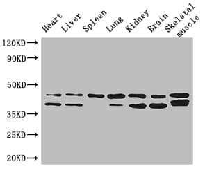 Polyclonal Rabbit anti-Human DGAT2 Antibody (IHC, IF, WB)