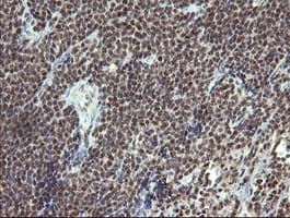 ESRRG / ERR Gamma Antibody (clone OTI6G1)