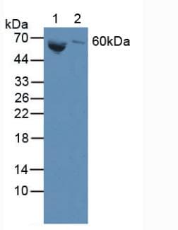 GLB1 / Beta-Galactosidase Antibody (aa68-219)