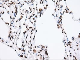 ERIC-1 / TACC3 Antibody (clone OTI6F1, Carrier-free)