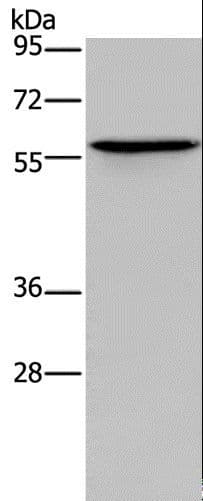 ADRA1B / Adrenoceptor alpha 1B Antibody