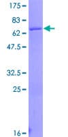Human ACAA1 Protein (Recombinant GST)