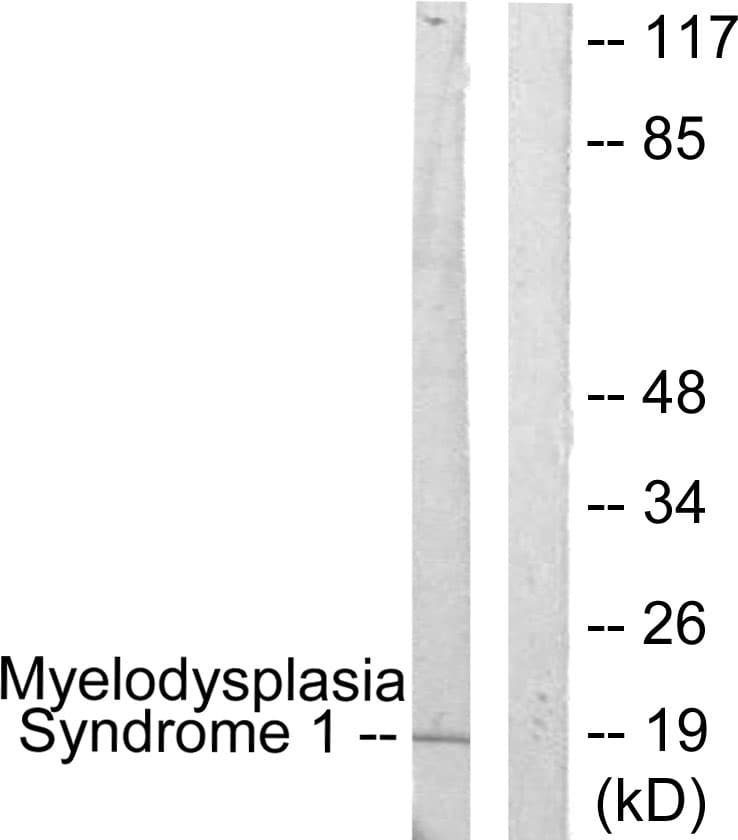 Polyclonal Rabbit anti-Human MECOM / EVI1 Antibody (aa1-50, WB)