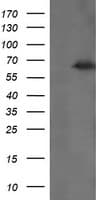 TRMT2A Antibody (clone OTI1H2)