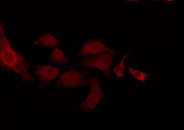 Polyclonal Rabbit anti-Human CNTN2 / TAX Antibody (IF, WB)