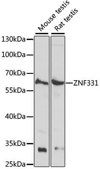Polyclonal Rabbit anti-Human ZNF331 Antibody (WB)