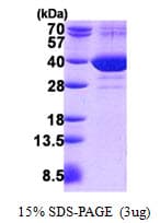 Human FAM49B / L1 Protein (Recombinant His)