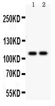 ATP2A1 / SERCA1 Antibody (aa1-32)