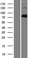 CEP78 / IP63 Protein (Over-Expression Lysate Myc-DDK (Flag))