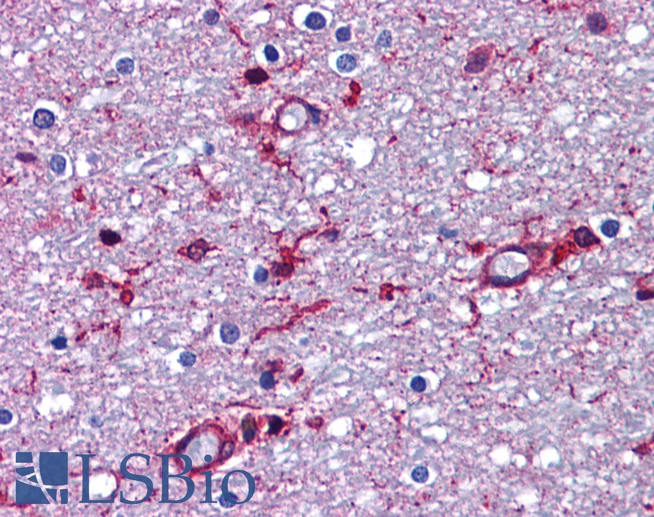 Polyclonal Rabbit anti-Human APP / Beta Amyloid Precursor Antibody (IHC, IF, WB)