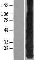 MT1E Protein (Over-Expression Lysate Myc-DDK (Flag))