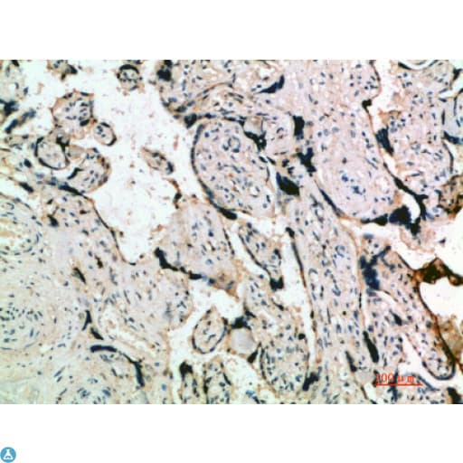 INHA / Inhibin Alpha Antibody