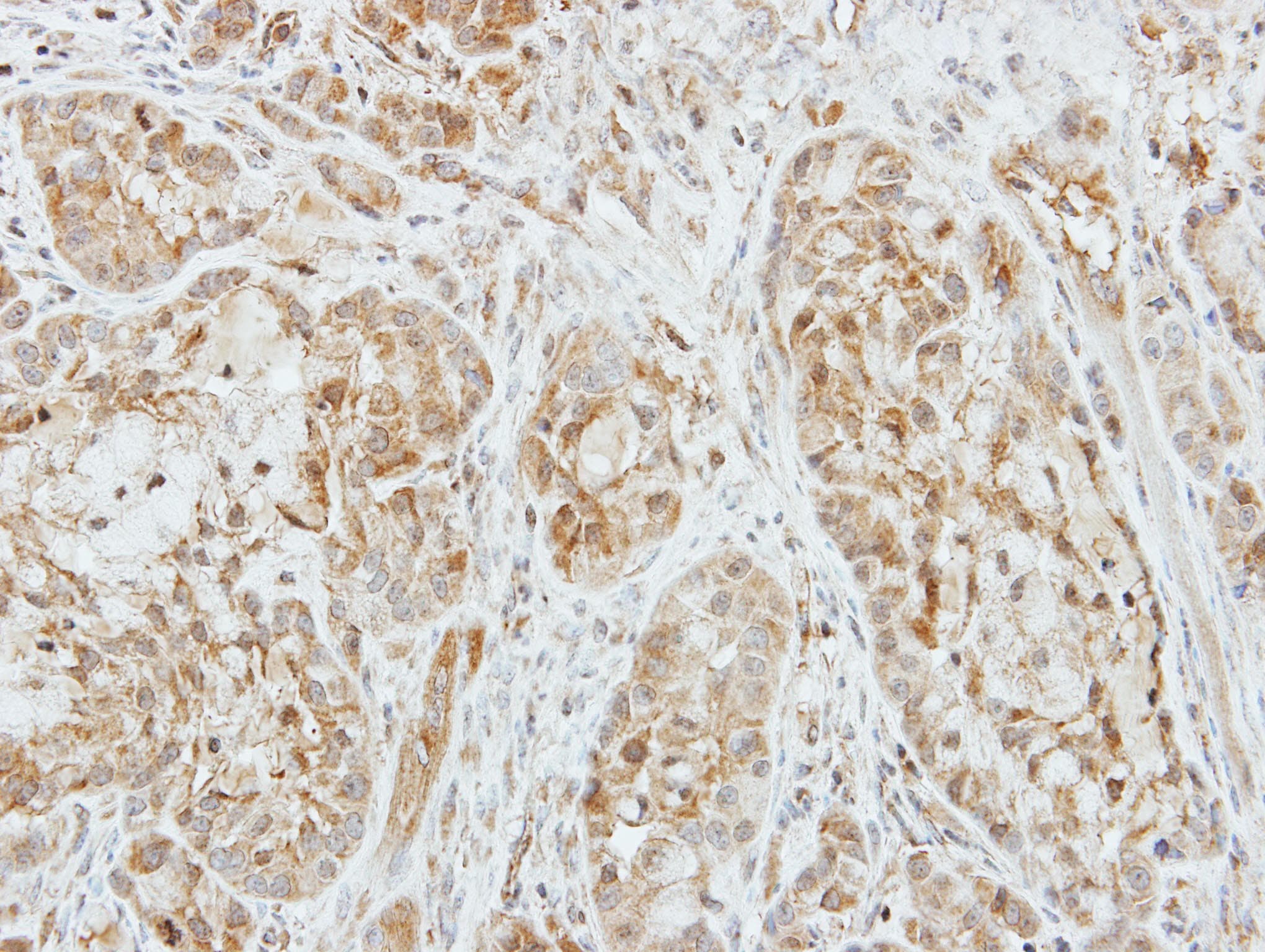 Polyclonal Rabbit anti-Human F10 / Factor X Antibody (aa33-312, IHC, WB)
