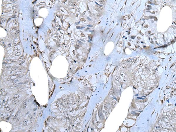 Polyclonal Rabbit anti-Human ZNF703 Antibody (IHC)