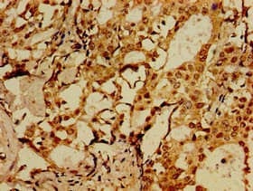 Polyclonal Rabbit anti-Human HSorCS / SORCS1 Antibody (IHC, WB)