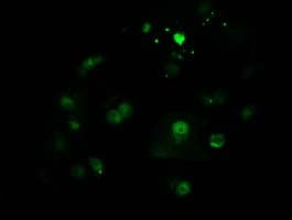 CTDSP1 / SCP1 Antibody (clone OTI1A10, Carrier-free)