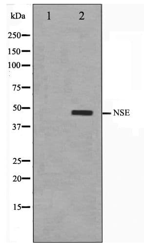 ENO2 / NSE Antibody