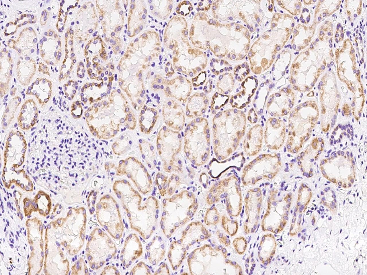 HSPC176 / TRAPPC2L Antibody