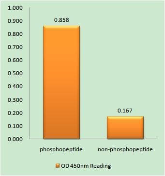 Polyclonal Rabbit anti-Human EPHA3 + EPHA4 + EPHA5 Antibody (phospho-Tyr779/833, IHC)