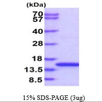 Human EIF1B Protein (Recombinant His)