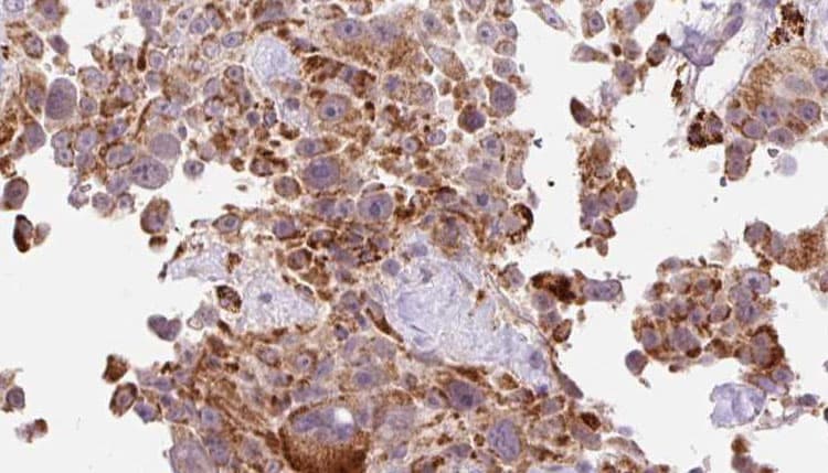 Polyclonal Rabbit anti-Human COL1A2 / Collagen I Alpha 2 Antibody (IHC, IF, WB)