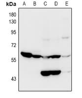 Polyclonal Rabbit anti-Human SLC22A5 / OCTN2 Antibody (WB)