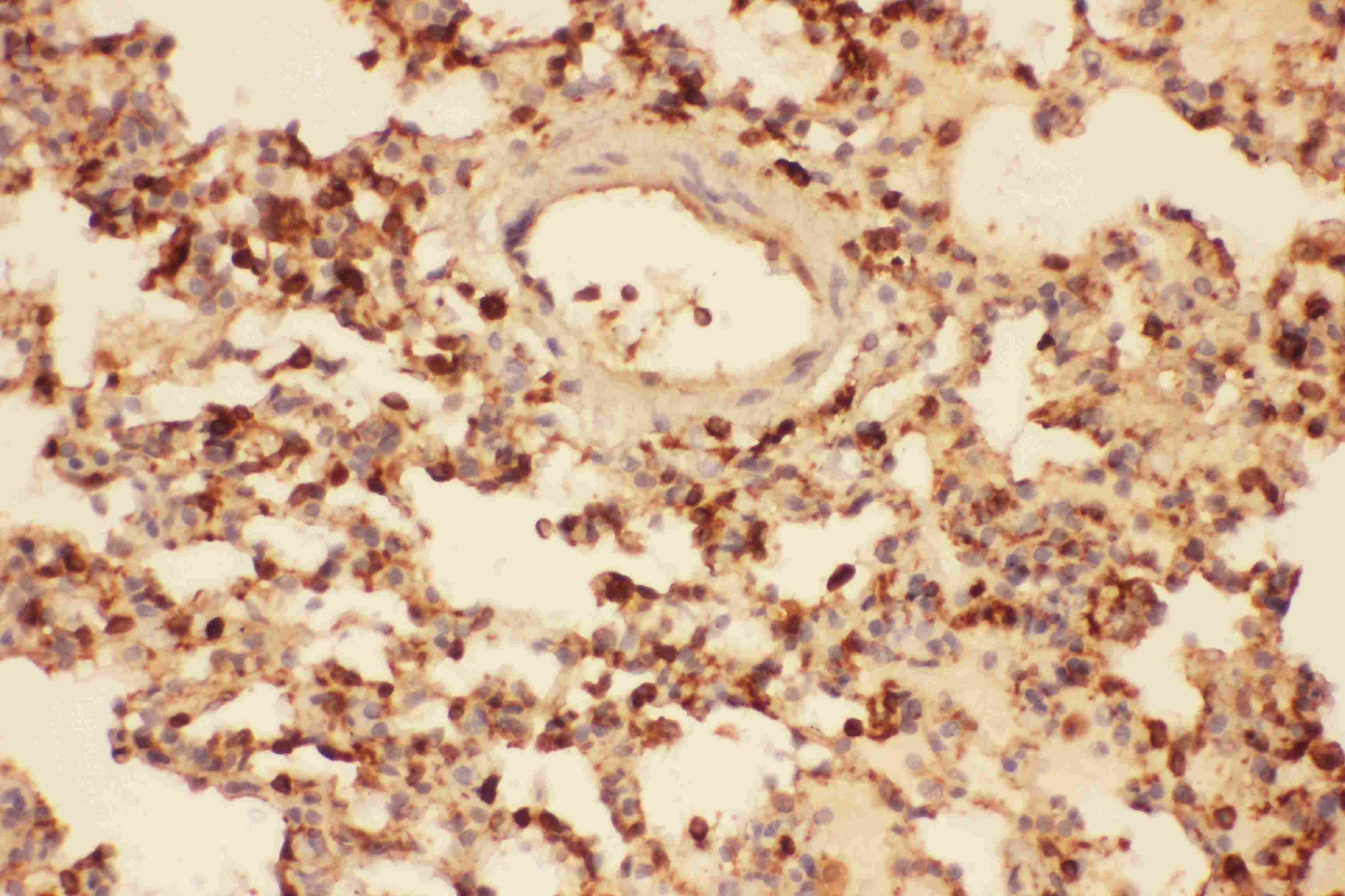 Polyclonal Rabbit anti-Human CFL1 / Cofilin Antibody (aa2-166, IHC, WB)