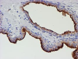 MEF2C Antibody (clone OTI2F2)
