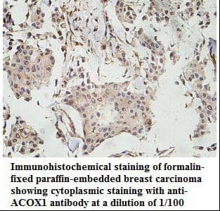 ACOX1 / ACOX Antibody (aa361-649)