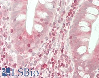 IHC-plus™ Polyclonal Rabbit anti-Human TAP2 Antibody (IHC, IF, WB)