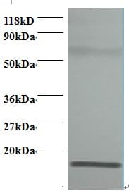 IHC-plus™ RPLP1 Antibody