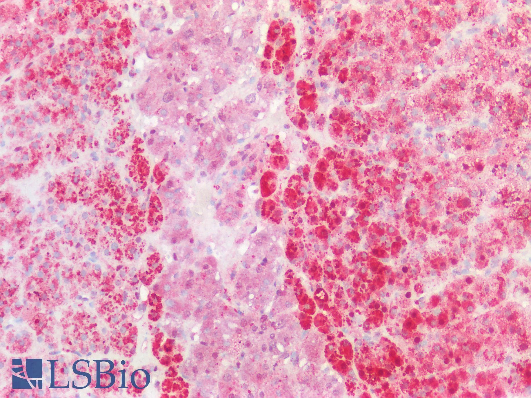 PathPlus™ Polyclonal Rabbit anti-Human APBA3 / MINT3 Antibody (aa352-401, IHC, WB)
