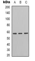 Polyclonal Rabbit anti-Human PDIA3 / ERp57 Antibody (Internal, WB)