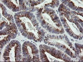 ZBED1 / TRAMP Antibody (clone OTI1F7)