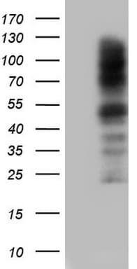 CEACAM5 / CD66e Antibody (aa35-680, clone OTI1C2)