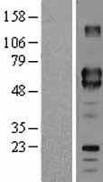 CD5 Protein (Over-Expression Lysate Myc-DDK (Flag))