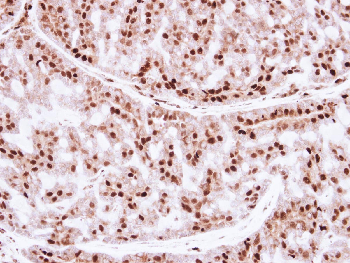 ZNF323 Antibody