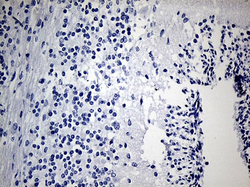 IMP-3 / IGF2BP3 Antibody (clone OTI7B10)