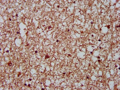 CKAP5 / ch-TOG Antibody