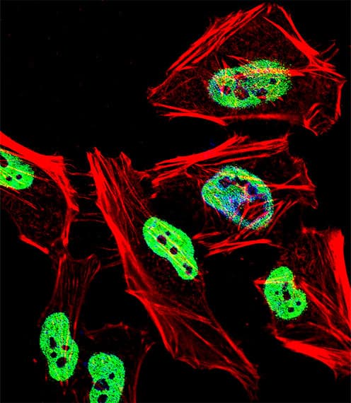 TRIM28 / KAP1 Antibody (aa178-207)