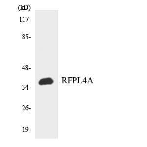 Polyclonal Rabbit anti-Human RFPL4A Antibody (aa138-187, WB)