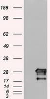 NEUROG1 / NGN1 / Neurogenin 1 Antibody (clone OTI9A8)