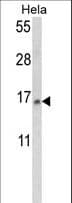 Polyclonal Rabbit anti-Human SNRPD2 Antibody (aa1-30, IHC, WB)