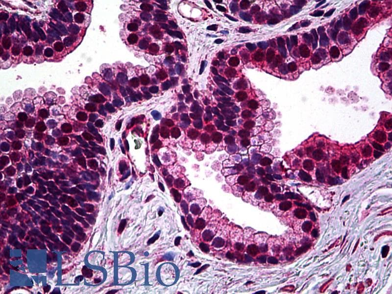 PathPlus™ SMC1A / SMC1 Antibody (clone 1B9)