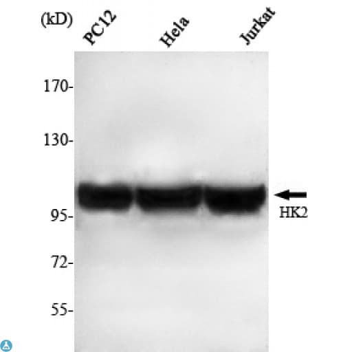 HK2 / Hexokinase 2 Antibody