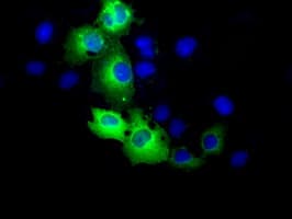RIP1 / RALBP1 Antibody (clone OTI6G10)